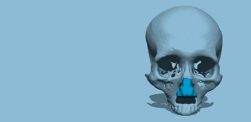 Cosmetic surgery, Nose