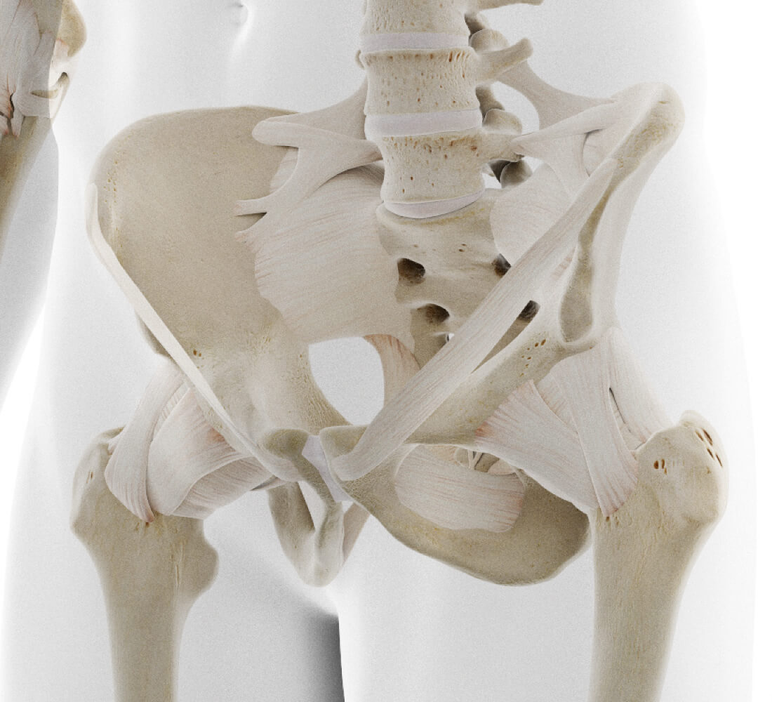 Pelvic ring fracture