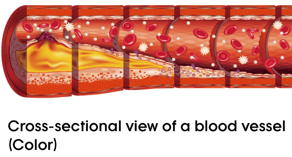 Illustrative illustration of the device