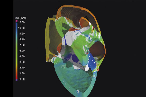 High-precision 3D measurement