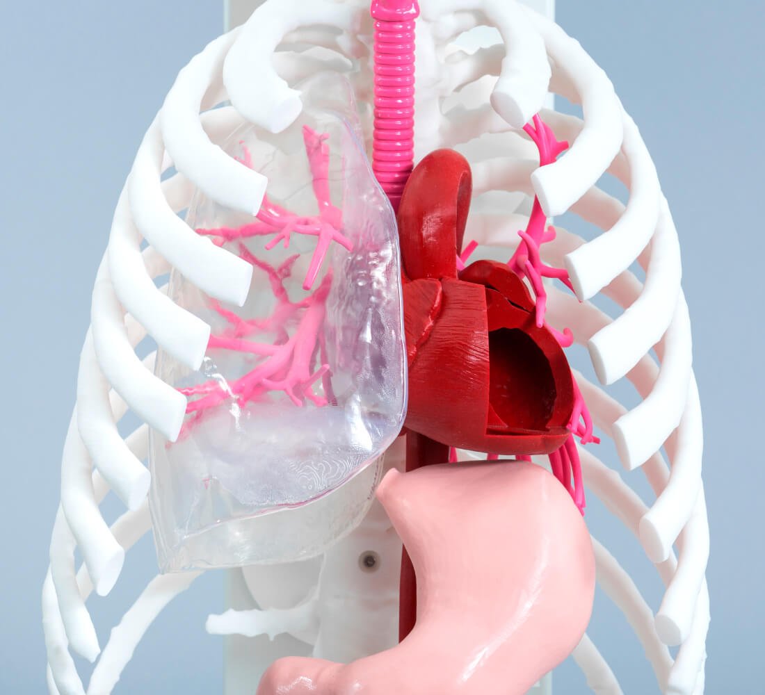 Bronchial preoperative simulation model