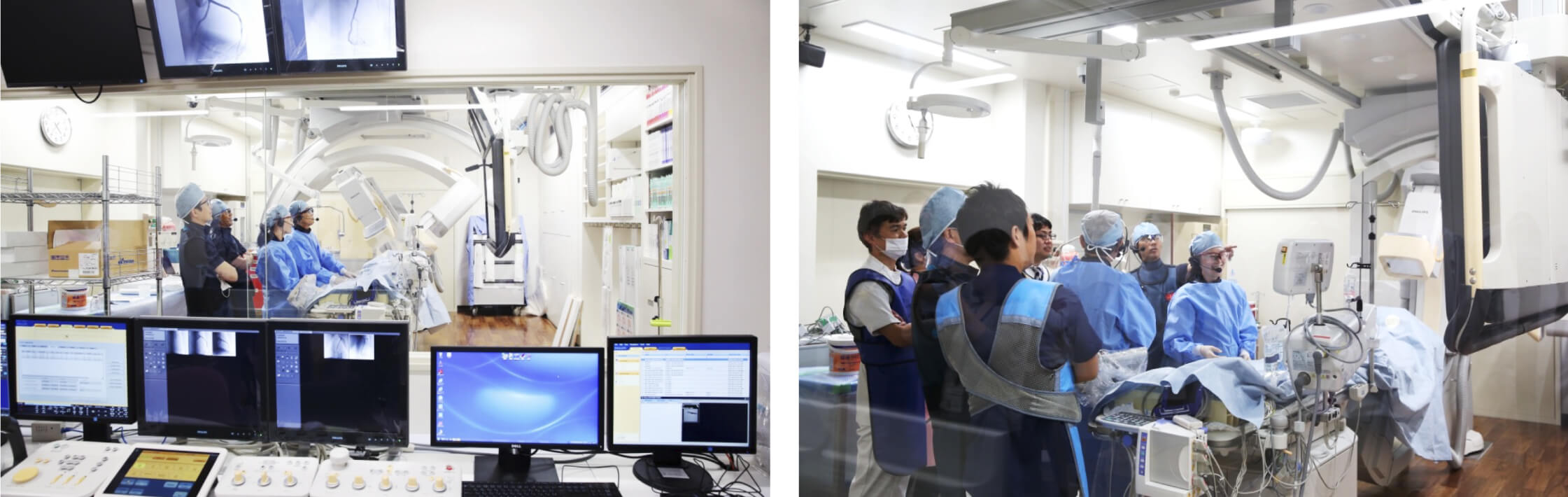 バイプレーン血管撮影装置の導入評価