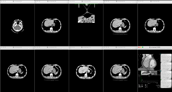 歯科用CTや医療用CT