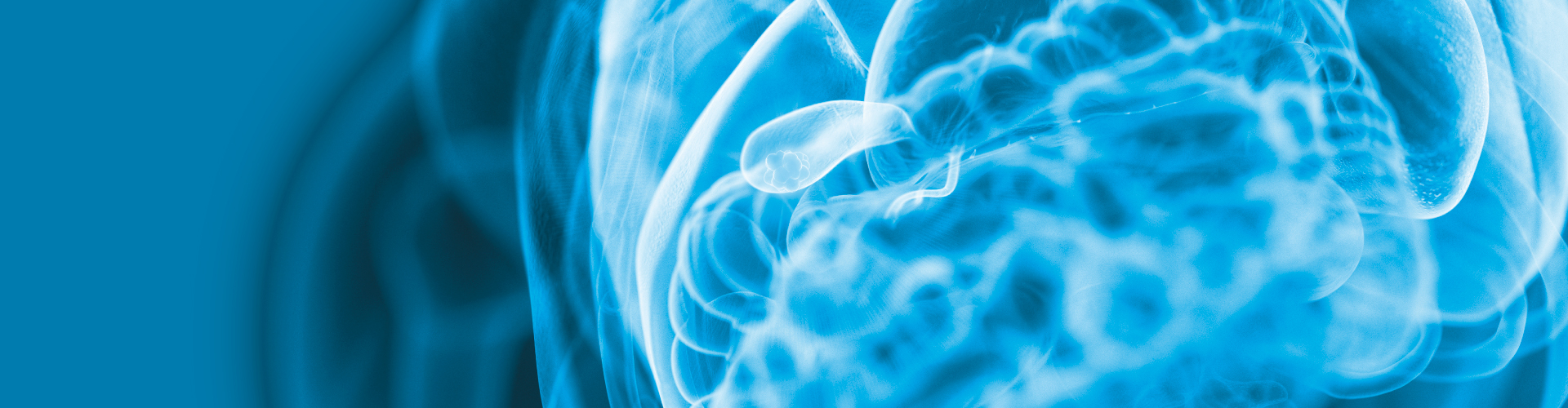 NON-IVUS
